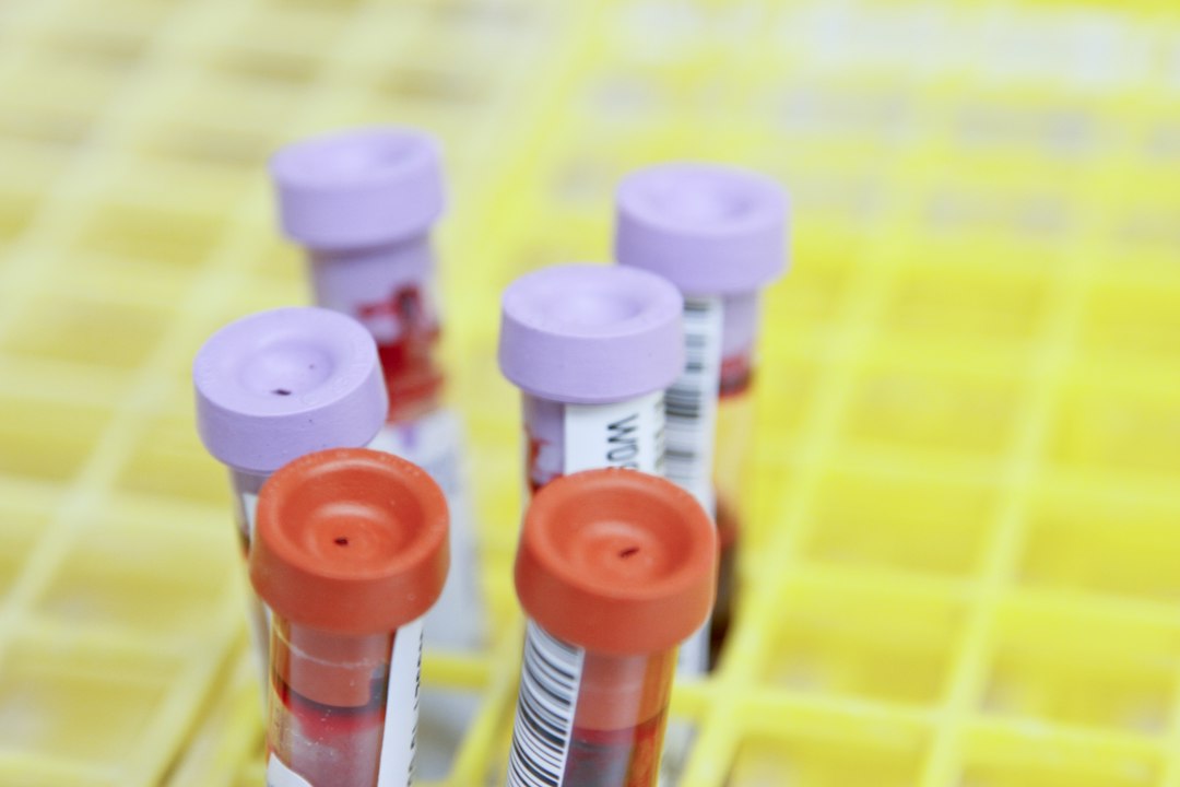 Blood samples in laboratory test tubes